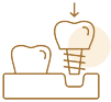 インプラント治療