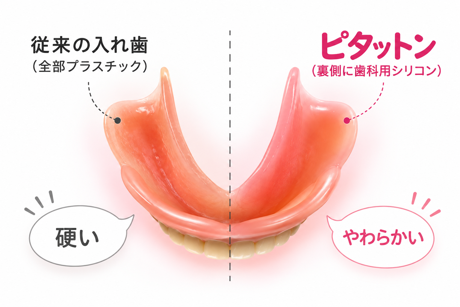 クッション付き総入れ歯ピタットン